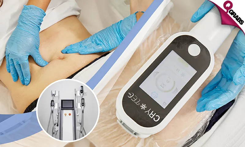 Cryotec 360° Fat Freezing & Endospheresculpt Contouring + Consultation for Ladies!